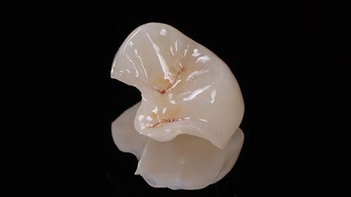 08 02. 成品近照. 留意牙齒上細微的解剖構造